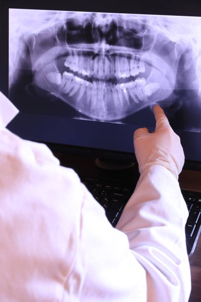 Best Emergency Dental Care for Broken or Chipped Teeth in Elm Creek, NE