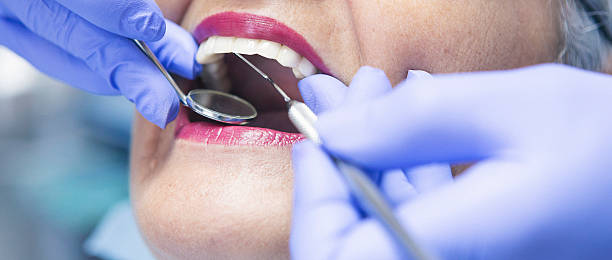 Best Emergency Treatment for Dental Infections or Abscesses in Elm Creek, NE